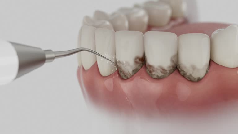 Trusted Teeth Cleaning And Checkup service in Lindsay, TX - Dentist Open Now